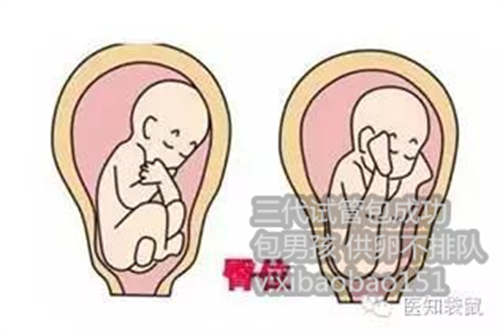 南京捐卵群二维码,45绝经后做试管婴儿